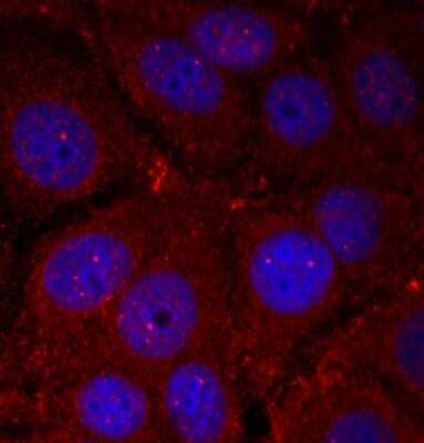 Immunocytochemistry/ Immunofluorescence: alpha-Synuclein [p Tyr136] Antibody - Azide and BSA Free [NBP3-05404]